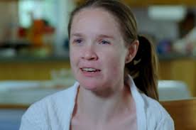 Mujer vive con medio cerebro