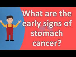 Stomach cancer may or may not present with vague gastrointestinal symptoms, including indigestion, abdominal pain or discomfort. What Are The Early Signs Of Stomach Cancer Faqs On Health Youtube