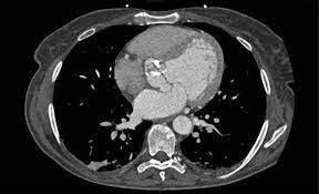 Fizz Ct Scan Ct Scan Machine
