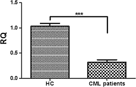 Sparc Is Underexpressed In Cml Patients At Diagnosis