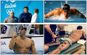 So what is cupping therapy, and why would anyone want to do it? Jfmk Free Full Text Could Cupping Therapy Be Used To Improve Sports Performance Html