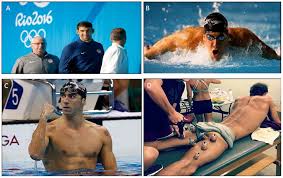 T his week everyone's talking about cupping, a therapy that some olympic athletes competing in rio have been partaking of.it caught people's attention this week because the therapy often. Jfmk Free Full Text Could Cupping Therapy Be Used To Improve Sports Performance Html