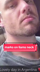 liam Payne #liampayne #news #breaking #update #argentina🇦🇷 #foryou #fyp