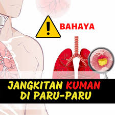 Sehingga, yang perlu kita lakukan adalah memastikan bahwa organ ini bisa bekerja dengan baik. Wajib Baca Jangkitan Cendawan Susu Harimau Original Facebook