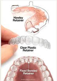 If surfaces are dirty, they should be cleaned using a detergent or soap and water prior to disinfection. Why Retainers After Orthodontic Treatment Are Very Important
