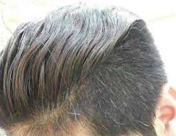This treatment for grey hair is great and works wonders in producing the required amount of melanin to hair. Premature Greying Hair Treatment Signs Symptoms Dr Bagadia S