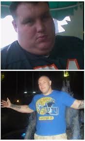 ONGAR: Man loses 24 stone after life-saving op