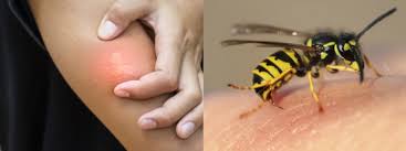 Also known as peking willow or tortured willow, globe willow's (salix matsudana) distinctive lime green leaves, sweeping branches and a spreading, rounded habit make it an attractive specimen. Do Wasps Sting Us For No Reason Truly Nolen Canada