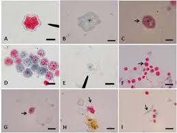 Check spelling or type a new query. Scielo Brasil Potentially Pathogenic Free Living Amoebae In Some Flood Affected Areas During 2011 Chiang Mai Flood Potentially Pathogenic Free Living Amoebae In Some Flood Affected Areas During 2011 Chiang Mai Flood