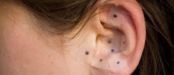 Maybe you would like to learn more about one of these? Bad Science Lends A Friendly Ear To Ear Seeds Office For Science And Society Mcgill University