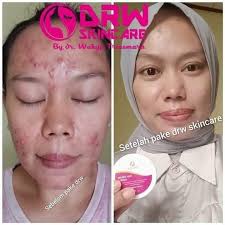 Mesin obras benang 5 Juki. Istimewa. Suara halus dinamo servo. Lokasi  Kepanjen. 081906113091