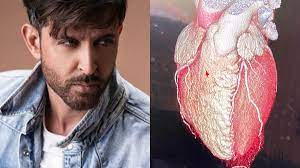 Find hrithik roshan news headlines, photos, videos, comments, blog posts and opinion at the indian express. Hrithik Roshan Shares His Heart Out Literally Celebrities News India Tv