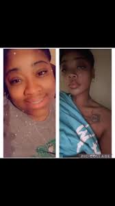 Dr Sousa is Metro Detroit’s Premiere Weight Loss Surgeon. He performs  various techniques for weight loss surgery including Sleeves, Gastric  Bypasses, Duodenal Switches, Gastric Balloons, and even ...