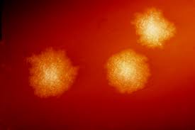 Diff is a germ (bacterium) that causes severe diarrhea and colitis (an inflammation of the colon). Clostridioides Difficile Bacteria Wikipedia