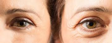 Pin En Cirugia Facial