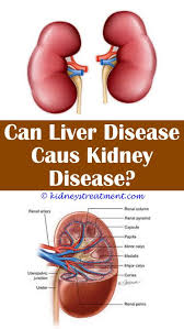 Kidney Stones Ultrasound Kidney Failure Symptoms Kidney Disease Kidney Disease Drinks