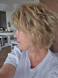 Any reviews for Dr Israel espino? Looking for a deep plane face lift with  minimal scarring. Thank you