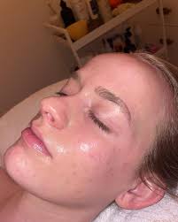 Natalie Tuttle ✨ Utah Master Esthetician (@skinwithnatt) • Instagram photos  and videos