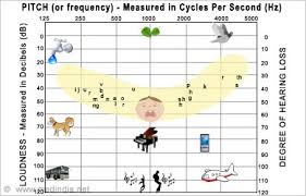 Audiometry The Hearing Test Audiometer Procedure