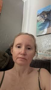 Recommendations for a chemical exfoliant and eye cream for dry/sensitive  skin? 🥰 The past few months I have noticed my forehead has an uneven  texture with a few skin coloured bumps/spots that