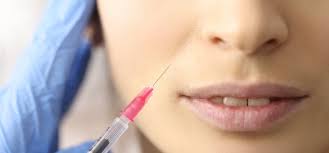 One united states clinical site.participants: Cosmetic Dermatology Illinois Dermatology Institute