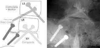 Barium Sulfate An Overview Sciencedirect Topics