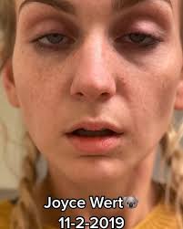 When my dad went to jail for child abuse I was 17, that’s when I started to  smoke dabs & weed. , At 17 I moved to college, during my 1st week my  bestfriend Ashlee died. I turned to drugs to cope. ...