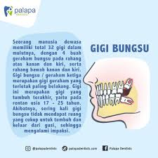Terjemahan dari gigi geraham di bahasa inggris. Palapa Dentists Photos Facebook