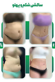 نظرات در مورد لیپوساکشن+نظرات در مورد لیپوساکشن غبغب+فیلم ساکشن غبغب+چرا بعد از ساکشن غبغب باید گن بست