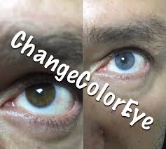 The eye color of people differs. Changing Eye Color The Changingeyecolor Permanently Greeneyes Greeneyecolor Eyecolorchangeperm In 2021 Eye Color Change Eye Color Change Surgery Change Your Eye Color