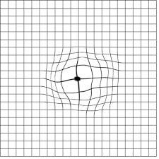 Amsler Grid