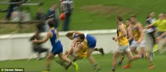 Young Aussie Rules Player Suffers Horrific Double Leg Break