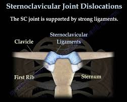 Image result for SC Dislocation