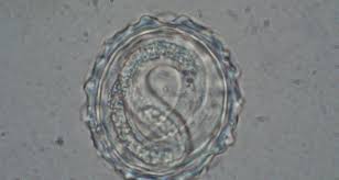 Image result for Whipworm