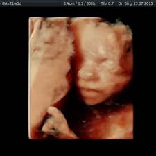 Ein rüde erreicht eine größe von 56 bis 58 cm bei einem gewicht von 29 bis zu 36 kg. á 22 Ssw Schwangerschaftswoche Alle Infos Grosse Entwicklung