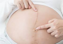 Ab wann kann ein fa genau sagen, ob eine ss besteht? Schwangerschaftsanzeichen Typische Erste Symptome Dm De