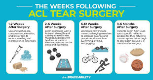 Pin On Redefining Acl Recovery Process