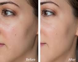 Find helpful customer reviews and review ratings for bareminerals matte spf 15 foundation, medium beige, 0.21 ounce at amazon.com. Everyday Minerals Jojoba Base Foundation Review Swatches Before After Jessoshii