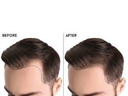 The roasting of the argan kernels over the fire has a negative effect on the ingredients. How To Use Argan Oil For Hair Growth