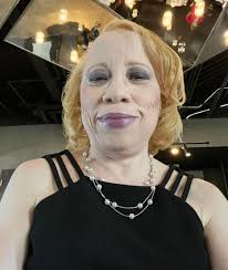 Stopping chemical hair processing after cancer