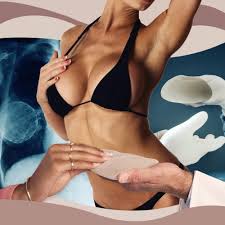 How long do breast implants last 2020. Is Breast Implant Illness Real Instyle