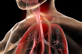 Early Warning Signals of Esophageal Cancer May Be Hiding in Plain Sight