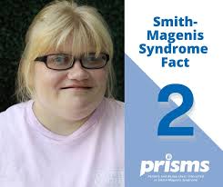 Common features of Smith-Magenis Syndrome include: characteristic, yet  subtle, facial appearance, infant feeding problems, low muscle tone,  developmental delay, variable levels of intellectual disability, early  speech/language delay, middle ear ...