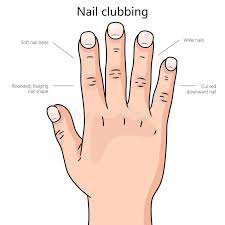 Image result for Digital Clubbing