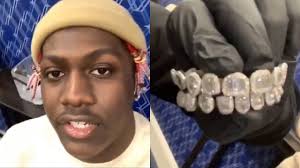 Lil uzi vert has hit headlines this week after getting a pink diamond implanted on his forehead. Patoloski Naplative Papir Lil Yachty Grill Bernardcharpenel Com