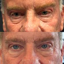 🌟💉🗿Dr. Jeffrey P Olson 🌟🗿💉 (@drjefflaps) • Instagram photos and videos