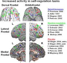 Image result for Placebo Effect