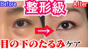 50 60代も1週間で激変 リバウンドしない目の下のたるみをとるマッサージ エクササイズ夜の美顔ヨガ youtube フェイスケア 顔のエクササイズ 目の下