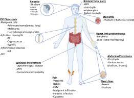 We did not find results for: Altered Mental Status In Guillain Barre Syndrome A Noteworthy Clinical Clue Mulroy 2020 Annals Of Clinical And Translational Neurology Wiley Online Library