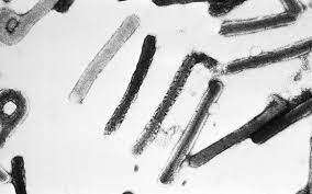 Quienes la sufren pueden sufrir síntomas agudos como fiebre moderada, conjuntivitis o dolores musculares y articulares. Eskgyowqrz16tm
